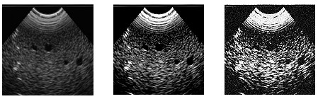 解析相機相關(guān)參數(shù)的設(shè)置-機器視覺_視覺檢測設(shè)備_3D視覺_缺陷檢測