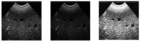 解析相機相關(guān)參數(shù)的設(shè)置-機器視覺_視覺檢測設(shè)備_3D視覺_缺陷檢測