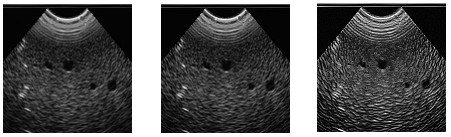 解析相機相關(guān)參數(shù)的設(shè)置-機器視覺_視覺檢測設(shè)備_3D視覺_缺陷檢測